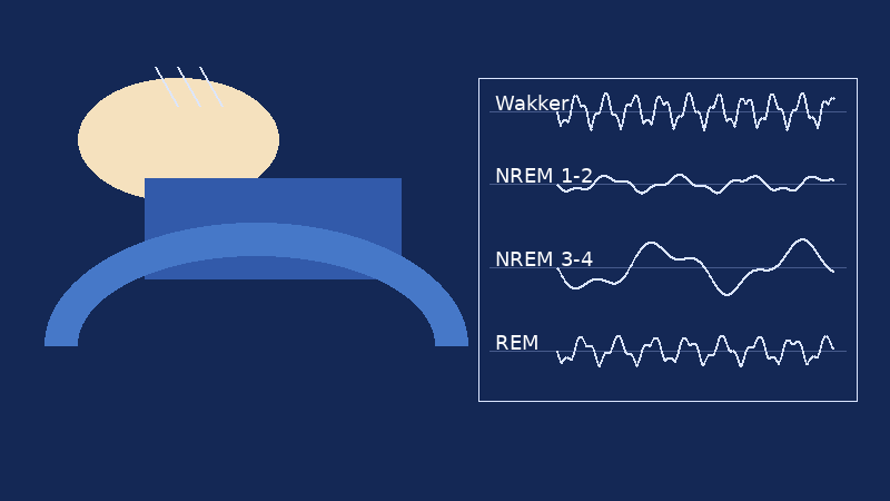 Slaap hersenen EEG diagram